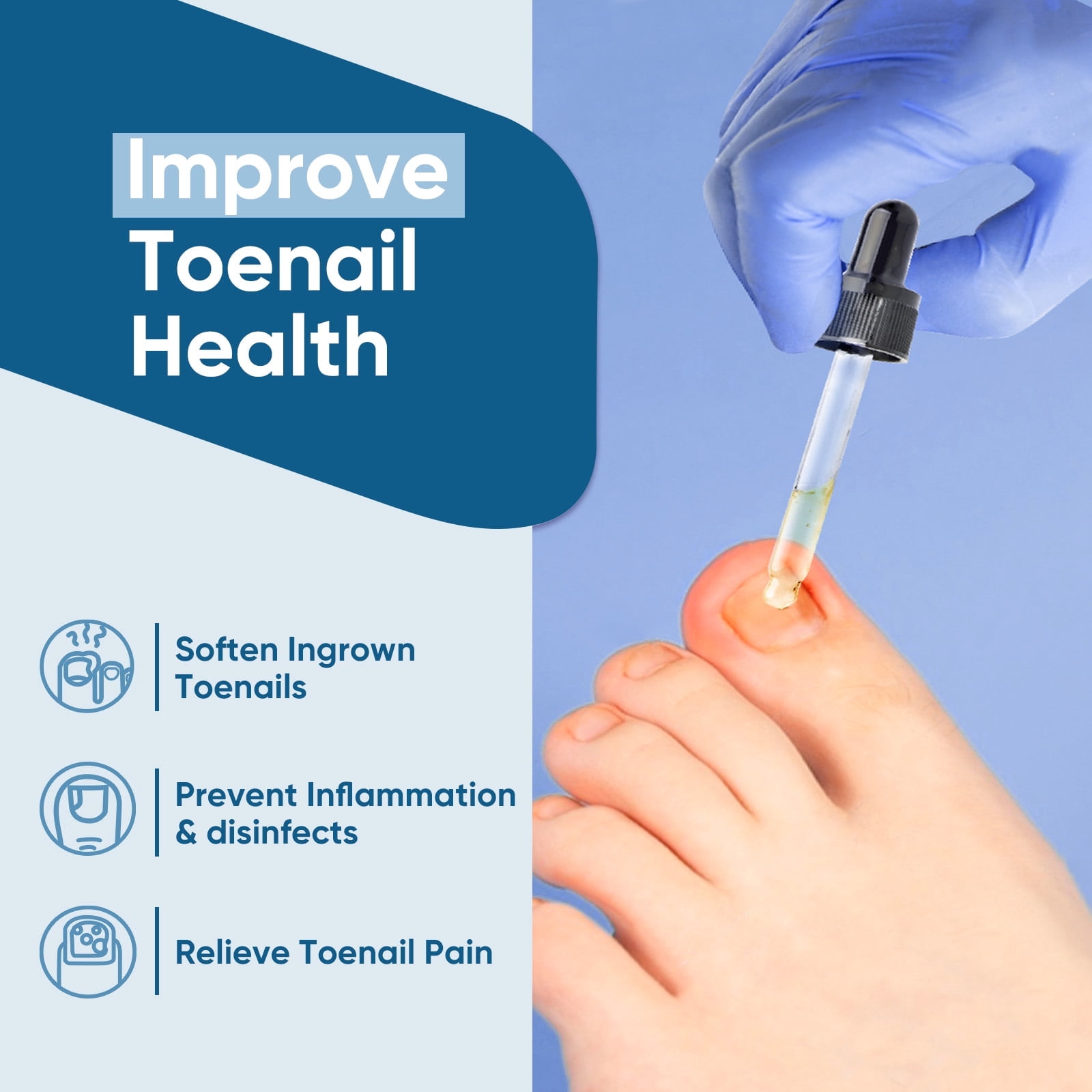 Ingrown Toenail Treatment, Ingrown Toenail Corrector, 30ml