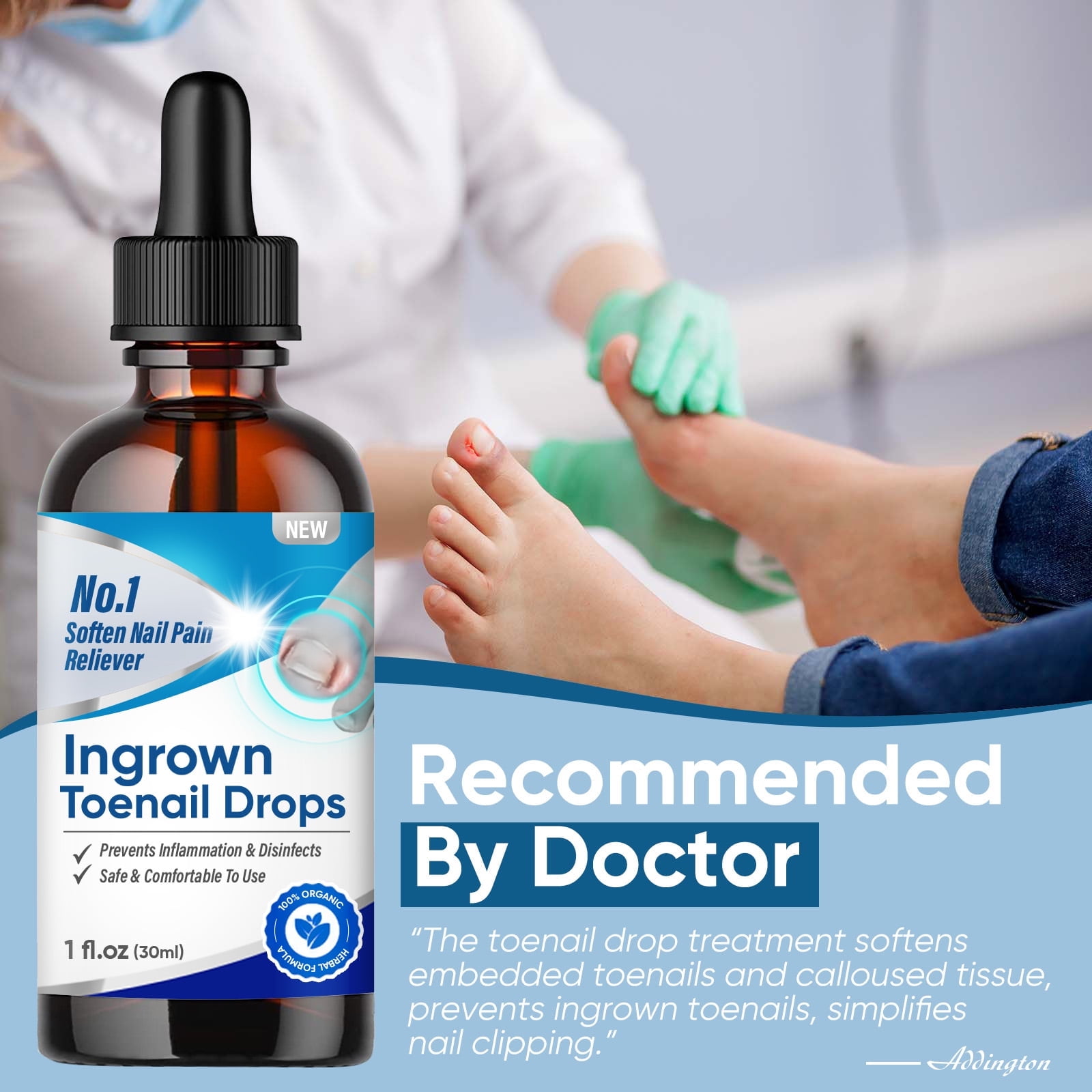 Ingrown Toenail Treatment, Ingrown Toenail Corrector, 30ml