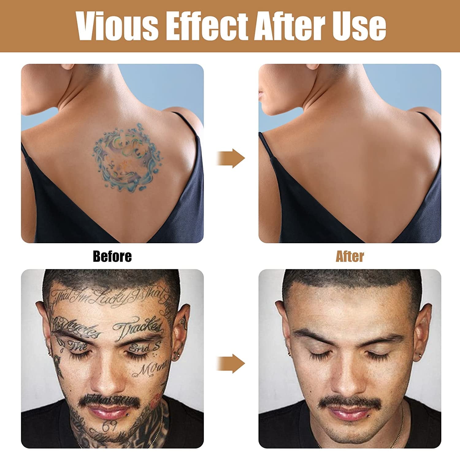 Tattoo Cover Up, Tattoo Concealer Makeup, 2 Colors waterproof concealer, Professional Waterproof Skin Concealer Set to Cover Tattoo/Scar/Acne/Birthmarks for Men and Women (2x20g)