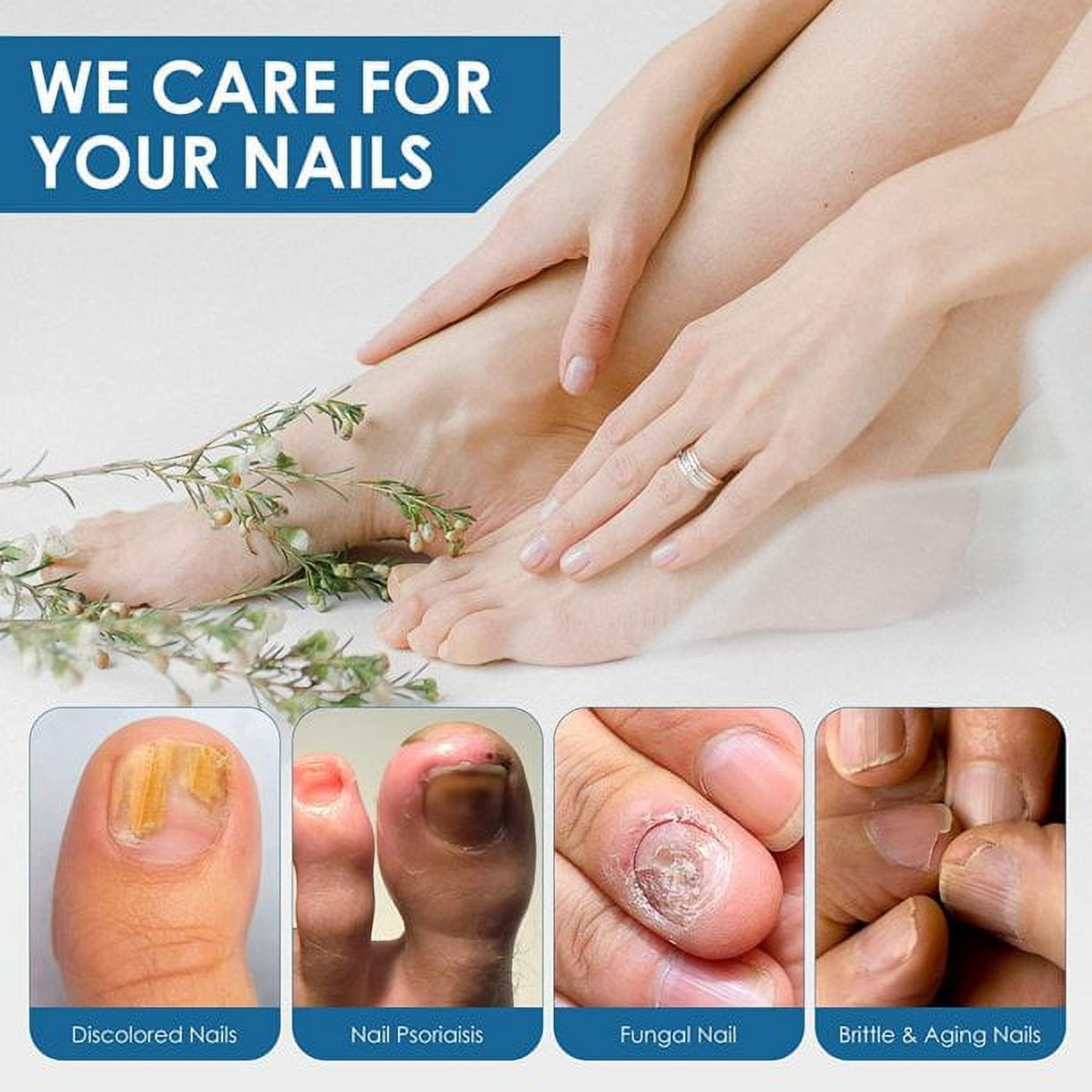 Toenail Fungus Treatment-30ml