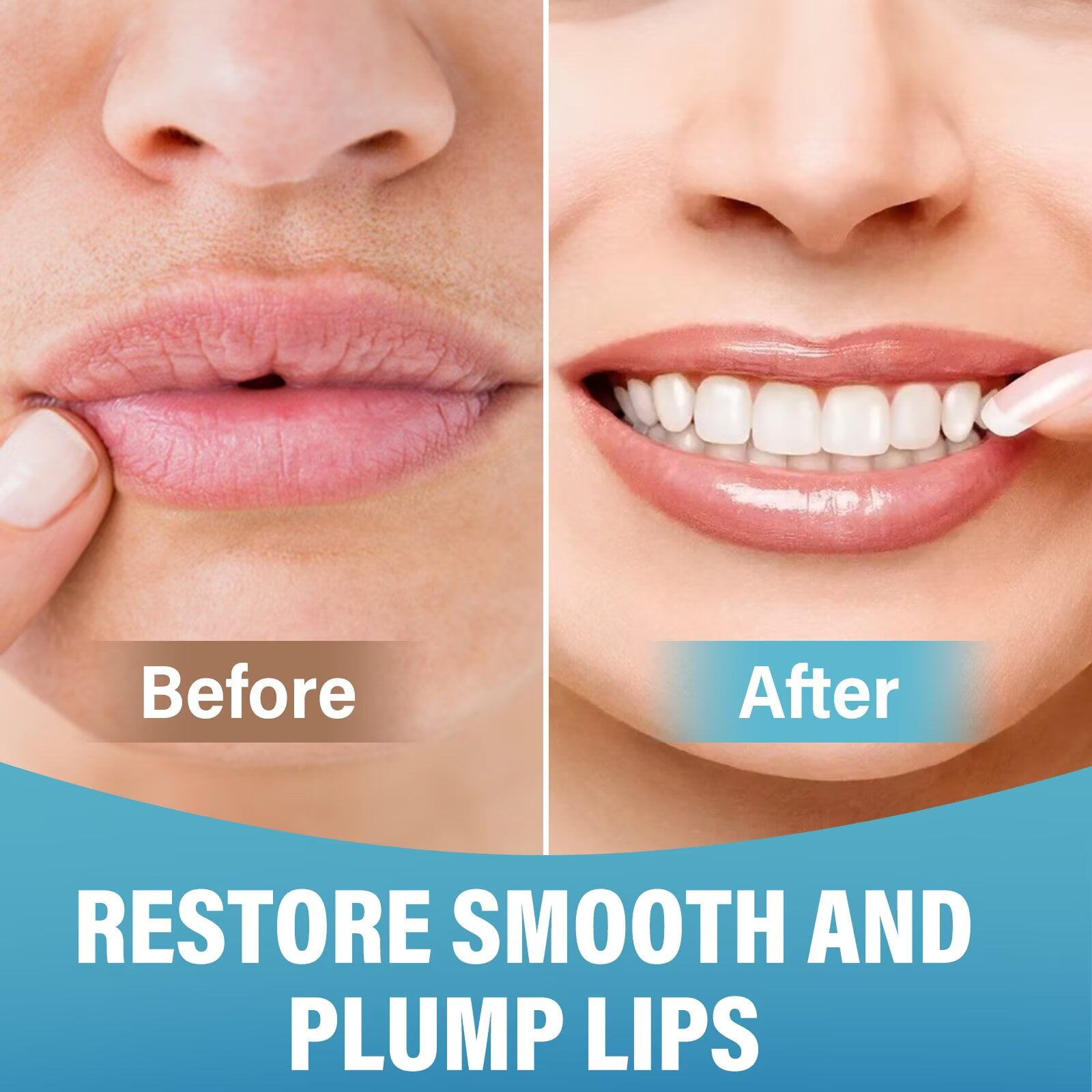 Anti Wrinkle Patches for Lip, Forehead, Cheek, Smile Line and Skin Around The Lips