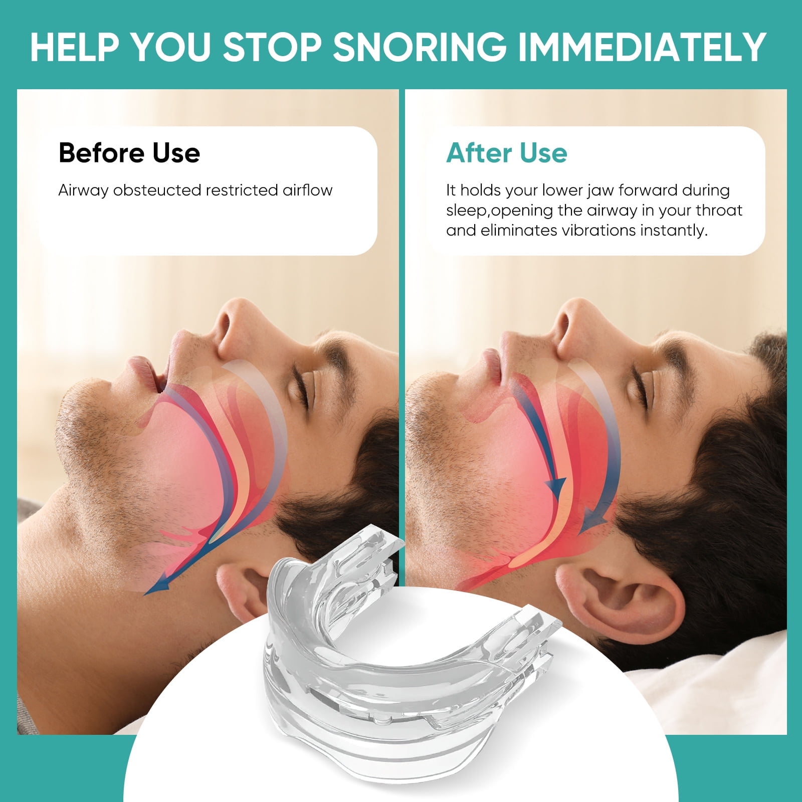 Anti Snoring Devices, Reusable & Effective Anti Snoring Mouth Guard for Men and Women
