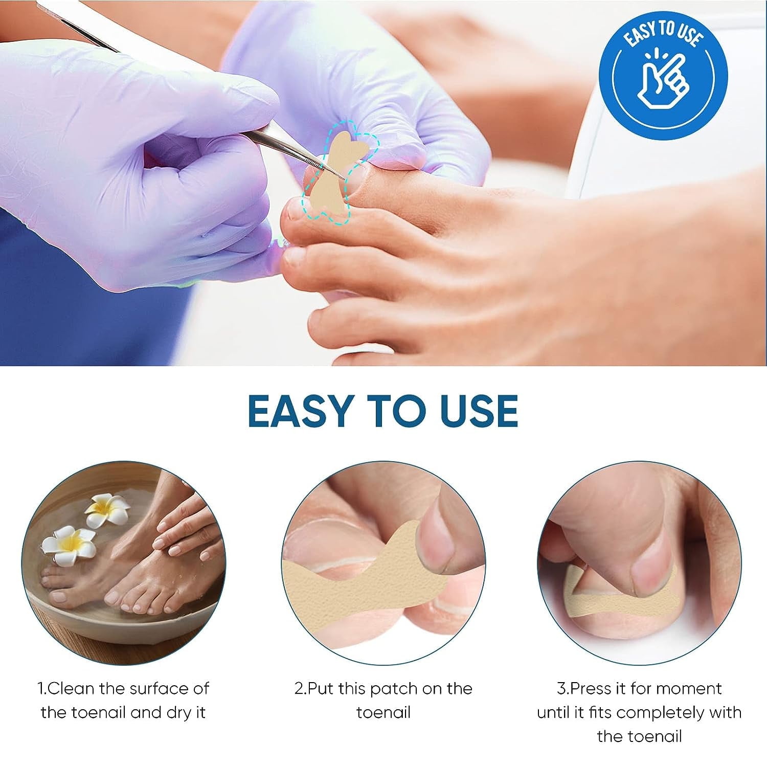 Ingrown Toenail  Treatment, Ingrown Toenail Removal Kit, Ingrown Toenail Correction Kit with Toenail File & Lifter, 50pcs