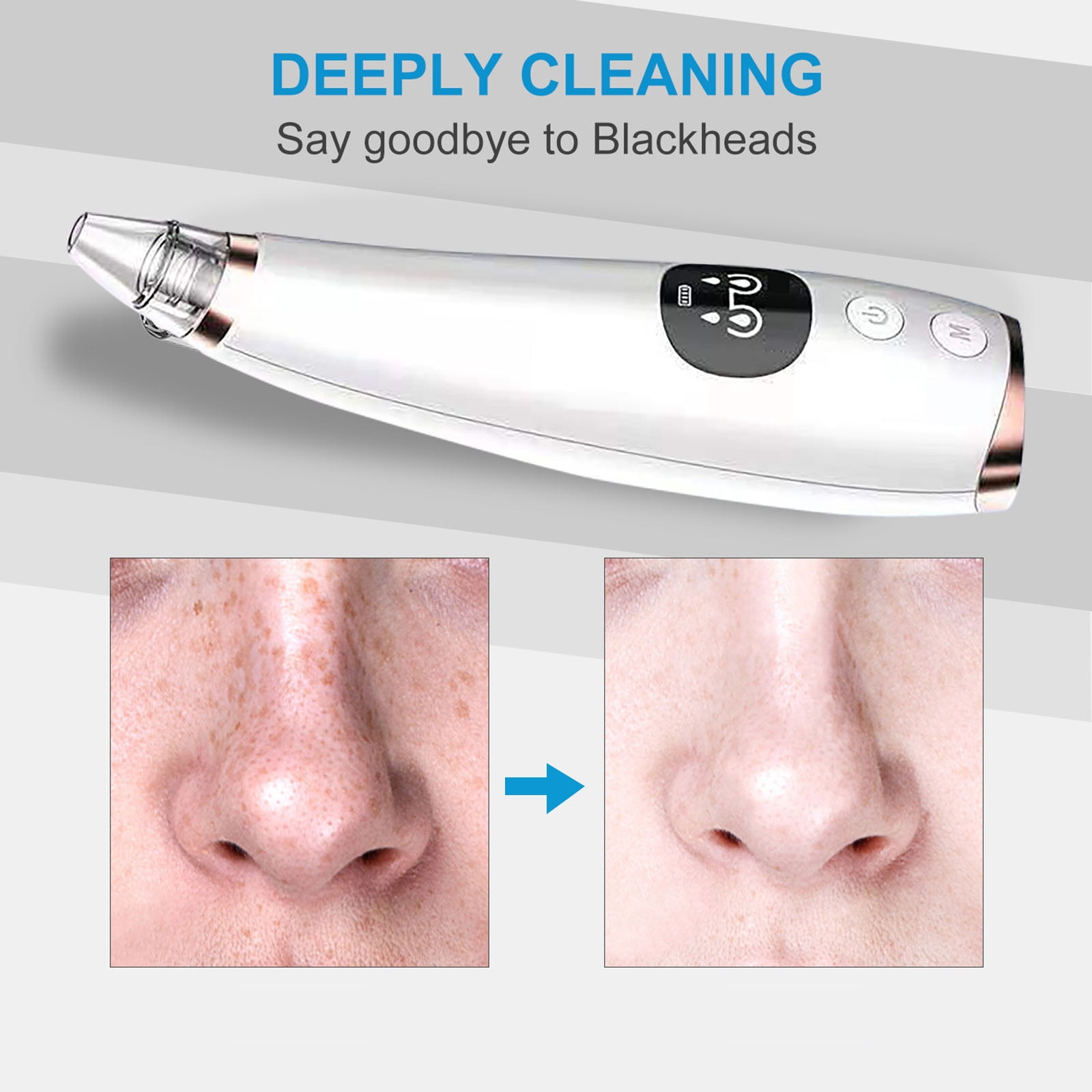 2026 Newest Blackhead Remover Pore Vacuum, USB Rechargeable Facial Pore Cleaner,3 Levels Adjustable Pore Vacuum Blackhead Remover, with 5 Suction Power, 5 Probes