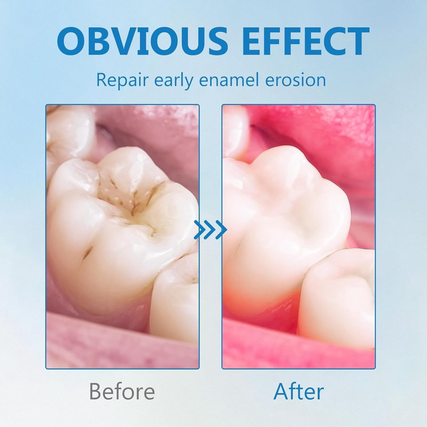 Cavity Healing Tooth Armor Liquid, Advanced Enamel Repair & Nano Hydroxyapatite Remineralization Drops for Sensitive Teeth - Supports Gum Health & Cavity Reversal